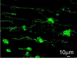 神経細胞蛍光